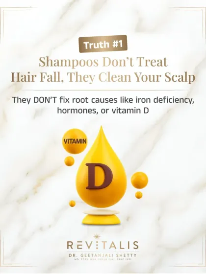 Truth number one: Shampoos are for cleansing the scalp, not treating hair fall. They cannot fix root causes like iron deficiency, hormonal imbalances, or low Vitamin D. Treatment heals, shampoo cleans.