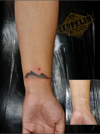 Here, a wrist scar is cleverly camouflaged with a minimalist mountain range tattoo. This before-and-after image shows how a small, thoughtful design can effectively cover a scar and turn it into a subtle piece of personal art.
