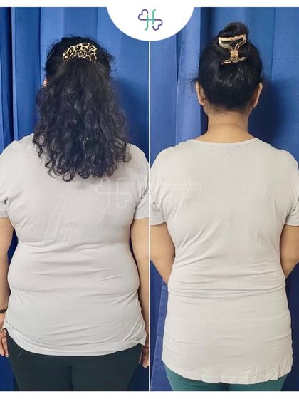 As a full time working mother of two, this client learned that consistency and self love are key. She lost 9 kgs in 6 months by following a flexible plan that fit her busy life, and she never doubted herself.