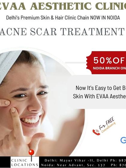 A promotional graphic for our acne scar treatments, emphasizing that it's easy to achieve beautiful skin with our expert care.