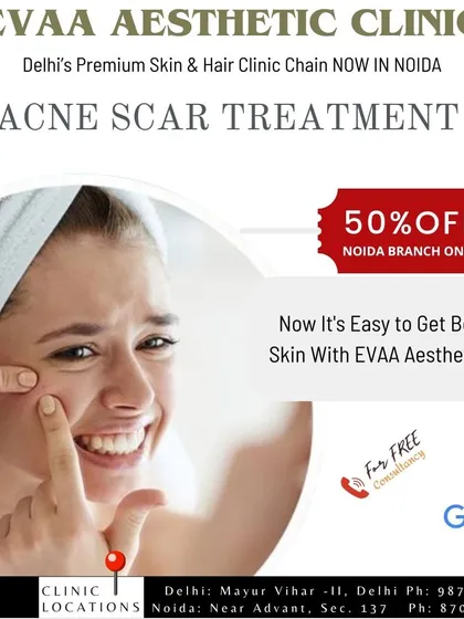 It's easy to get beautiful skin with Evaa Aesthetic Clinic. This image promotes a 50% discount on acne scar treatments at our Noida location.