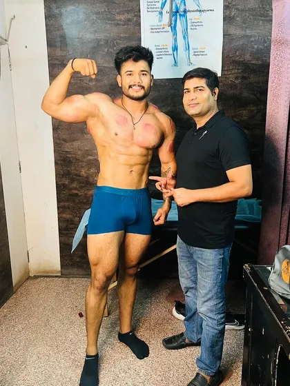 With professional athlete Ishant Rao after his Graston and cupping session.