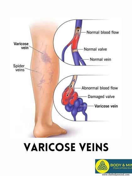 Body & Mind PhysioPilates Studio - Geriatric Fitness & Rehabilitation Rehabilitation for Specific Conditions photo 20
