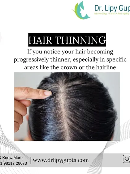 One of the key signs is progressive hair thinning, especially around the crown or a receding hairline. If you notice your part widening or less volume overall, PRP can help improve hair thickness and density.