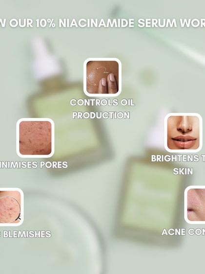 Here's how my 10% Niacinamide Serum works. It controls oil production, minimizes pores, fades blemishes, brightens the skin, and helps with acne control for a smoother complexion.