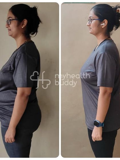 The side view of Kshitija's 11kg weight loss shows a dramatic change in her posture and confidence.