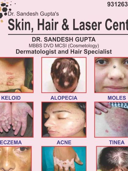 This is a collage showcasing the variety of common skin conditions I treat at my clinic. From keloids and alopecia to eczema, acne, and tinea, I have over 25 years of experience in providing effective solutions.