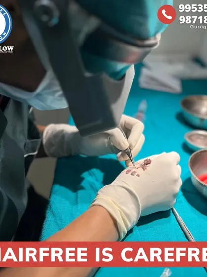 Here, individual hair grafts are being carefully prepared for transplantation. This delicate process is crucial for ensuring the viability of each follicle, which leads to higher success rates and denser hair growth.