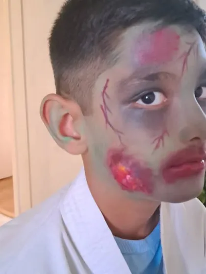 An example of costume prosthetic makeup. I created this zombie look using techniques to simulate bruised and wounded skin, showing how makeup can be used for special effects and theatrical transformations.