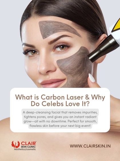 Here's why celebrities love the Carbon Laser Facial. It's a deep-cleansing treatment that removes impurities, tightens pores, and gives you an instant radiant glow with no downtime.