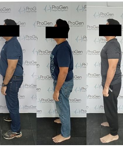 Ashok's inspiring journey shows his progress over time. He overcame belly fat and hypertension by embracing our personalized diet and healthier habits.