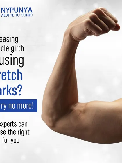 Are you developing stretch marks from increasing muscle girth at the gym? Don't worry. Our experts can choose the right laser treatment to help reduce their appearance and smooth the skin.