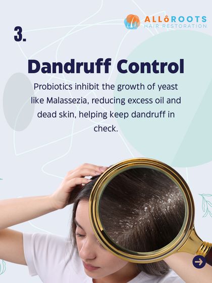 For dandruff control, probiotics can be very effective. They work by inhibiting the growth of yeast like Malassezia, which reduces the excess oil and dead skin buildup that causes flakes.
