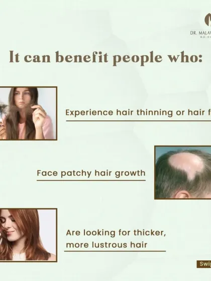 Hair Mesotherapy is beneficial for individuals experiencing hair thinning, patchy hair growth (alopecia areata), or those simply seeking thicker, more lustrous hair. It is a versatile tool in my hair restoration practice.