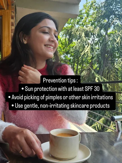 Prevention is key for managing hyperpigmentation. I always advise diligent sun protection, avoiding picking at pimples, and using gentle skincare products.
