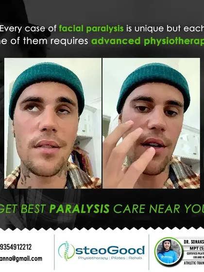 Facial paralysis, or Bell's Palsy, requires a very specific and gentle approach. I use advanced physiotherapy techniques to help patients regain facial muscle control, improve symmetry, and restore their confidence.