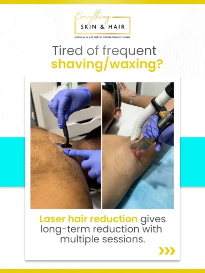 If you are tired of the cycle of shaving and waxing, laser hair reduction offers a long-term solution. This graphic illustrates the shift from temporary methods to a lasting reduction in hair growth over multiple sessions.