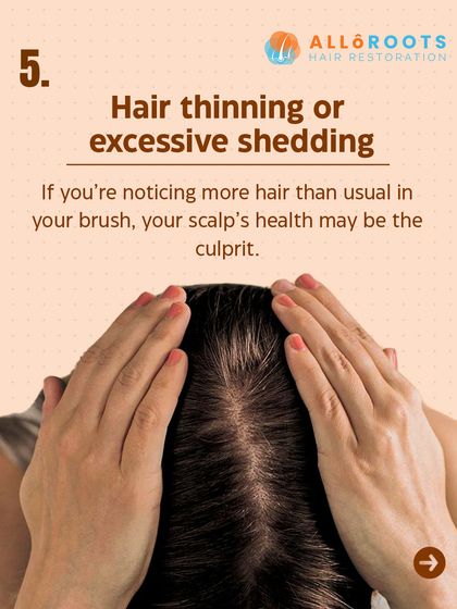 If you're noticing more hair than usual in your brush or shower, your scalp's health may be the culprit. Hair thinning or excessive shedding is often a direct result of an unhealthy scalp.
