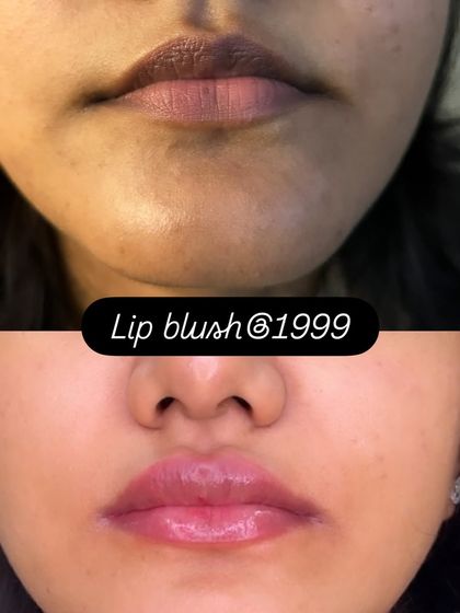 A subtle yet impactful lip blush result. This before and after shows how the treatment can even out skin tone and add a soft, healthy color for a 'your lips but better' look.