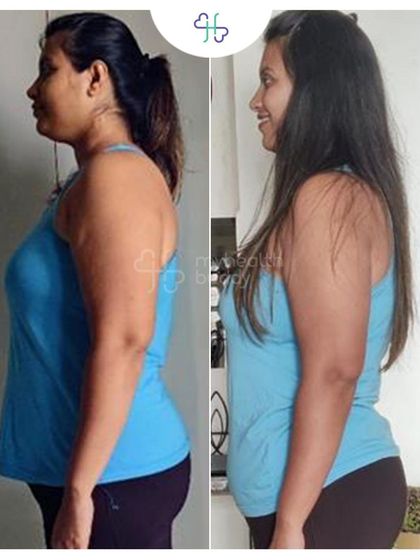 Ishani lost 7 kgs in 12 weeks by focusing on the basics: portion control and step tracking.