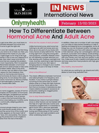 I was featured in Onlymyhealth to discuss the key differences between hormonal acne and adult acne. While they can look similar, understanding the triggers, such as hormonal fluctuations versus lifestyle factors, is essential for effective and long-lasting treatment.