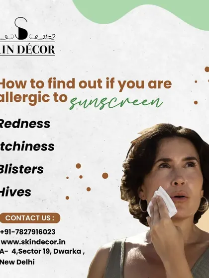 It is possible to be allergic to your sunscreen. Signs like redness, itchiness, blisters, or hives after application are red flags. If this happens, it's important to consult a dermatologist to find a suitable alternative.