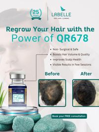 Hair Loss Treatment & Restoration