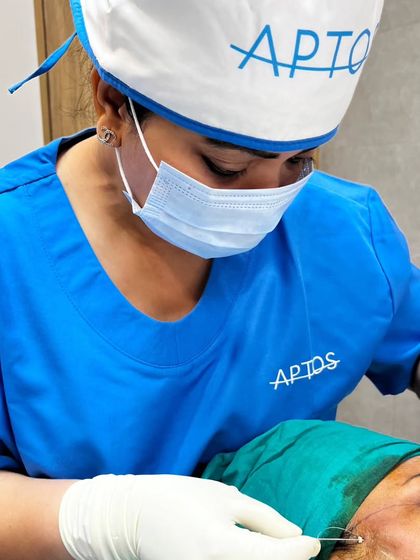 A close-up showing the insertion of an Aptos thread. These advanced threads are designed to provide superior lift and longevity, helping to redefine facial contours effectively.