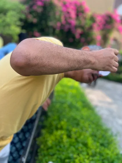 A student practices Jal Neti, a yogic cleansing technique, outdoors. This kriya is excellent for preparing the body's immune system for seasonal changes.