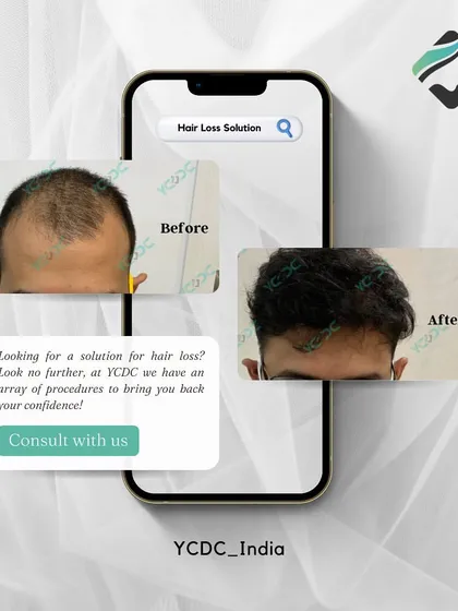 This graphic presents hair restoration as the solution you've been searching for. With an array of procedures, I can bring back your hair and your confidence.