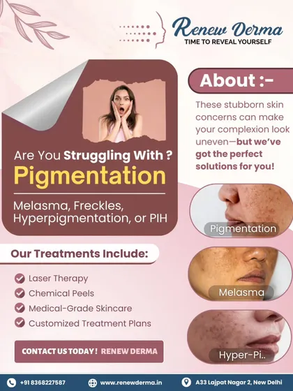 If you're struggling with melasma, freckles, or hyperpigmentation, we have a solution. Our treatments include laser therapy, chemical peels, and customized plans to restore your skin's clarity.