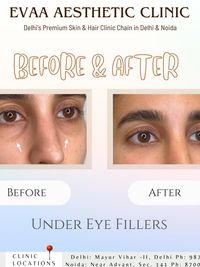 Anti-Aging Injectables