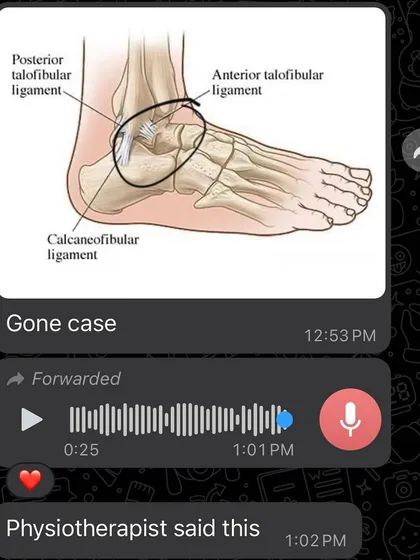 The initial diagnosis for Khushi's ankle. A physiotherapist called it a "gone case" for the upcoming competition. I don't believe in "gone cases". I believe in assessing the situation and finding a way to work around it.