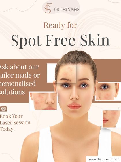 Ready for spot-free skin? I offer tailor-made laser solutions for issues like pigmentation, dullness, and uneven texture. These advanced treatments are safe, effective, and deliver visible results.
