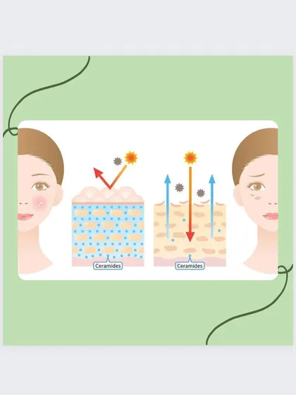 Visualizing the role of ceramides. A strong barrier keeps skin hydrated and protected, while a weak one leads to dryness and sensitivity.
