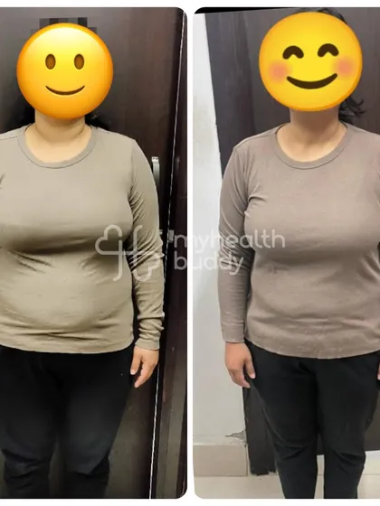 A front view of the same client's 9 kg weight loss. She learned how to create a healthy lifestyle that worked for her, and the results speak for themselves.