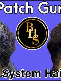 Non-Surgical Hair Replacement (Hair Patches & Systems)
