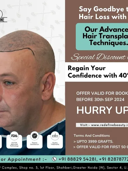 Regain your confidence with our special discount offer on advanced hair transplant techniques. Book your appointment soon to take advantage of this limited-time opportunity.