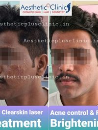 Corrective Skin Treatments