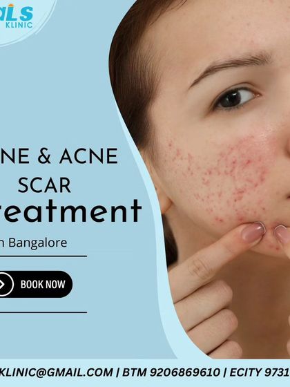 Vitals Klinic - Aesthetic Dermatology Acne & Scar Solutions photo 6