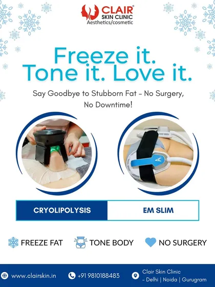 We offer a two-pronged approach to body transformation. This graphic summarizes our core services: Cryolipolysis to freeze and eliminate fat, and EM Slim to tone and build muscle. Together, they provide a complete, non-surgical body shaping solution.