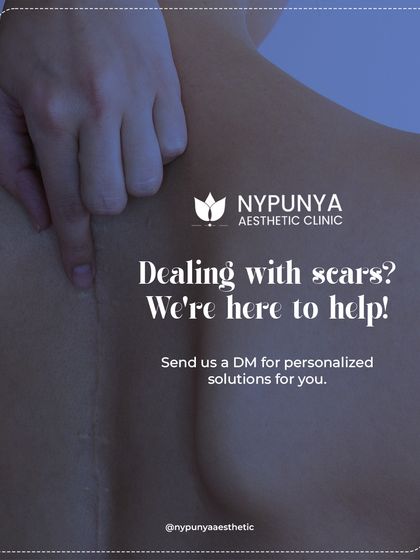 If you are dealing with scars that won't fade, we are here to help. I can create a personalized solution to address your specific type of scar.