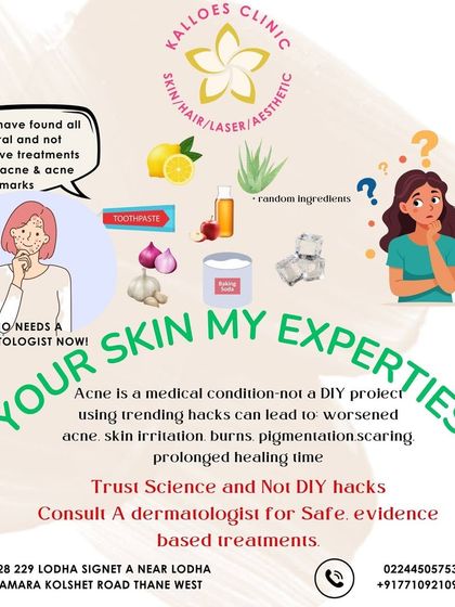 Please, trust science, not viral hacks. This graphic warns against using ingredients like toothpaste or lemon juice on your skin. These DIY remedies can cause burns, irritation, and worsen your acne. Always consult a dermatologist for safe treatment.