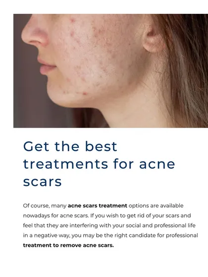 If acne scars are affecting your confidence, professional treatment can make a significant difference. We offer various options, from chemical peels to advanced laser therapies, to help you achieve smoother skin.