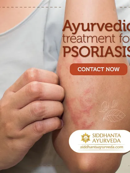 Finding a lasting solution for psoriasis is possible. I focus on a holistic treatment plan that addresses the internal imbalance causing the skin condition, not just the external symptoms.