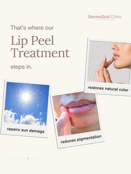 This graphic illustrates the triple-action benefits of a lip peel treatment: it repairs sun damage, reduces pigmentation, and helps restore the lips' natural, healthy color.