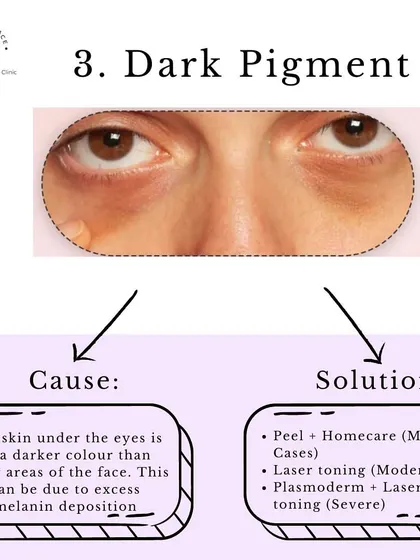 Problem: Dark Pigment. This is when the skin itself is a darker color due to excess melanin. Our solutions range from peels and homecare for mild cases to laser toning for more severe pigmentation.