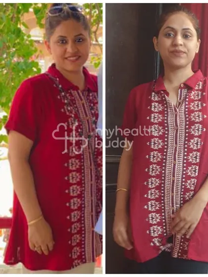 Shashi lost 12 kgs in 3 months, starting her journey 4.5 months after a C-section. Her transformation shows that with the right guidance, postpartum weight loss is achievable and safe.