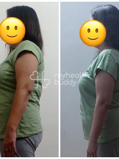 This client lost 3 kgs at the age of 48 while living a stressful life. More importantly, she feels more energetic and has learned how to sustain her results.