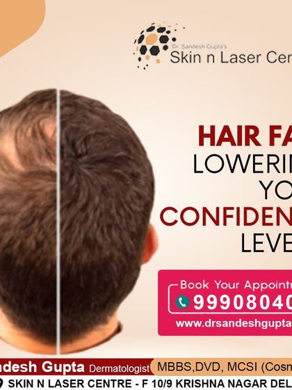 Hair fall can significantly lower your confidence. The first step to regaining it is to understand that hair loss is a medical condition that can be treated effectively with expert help.